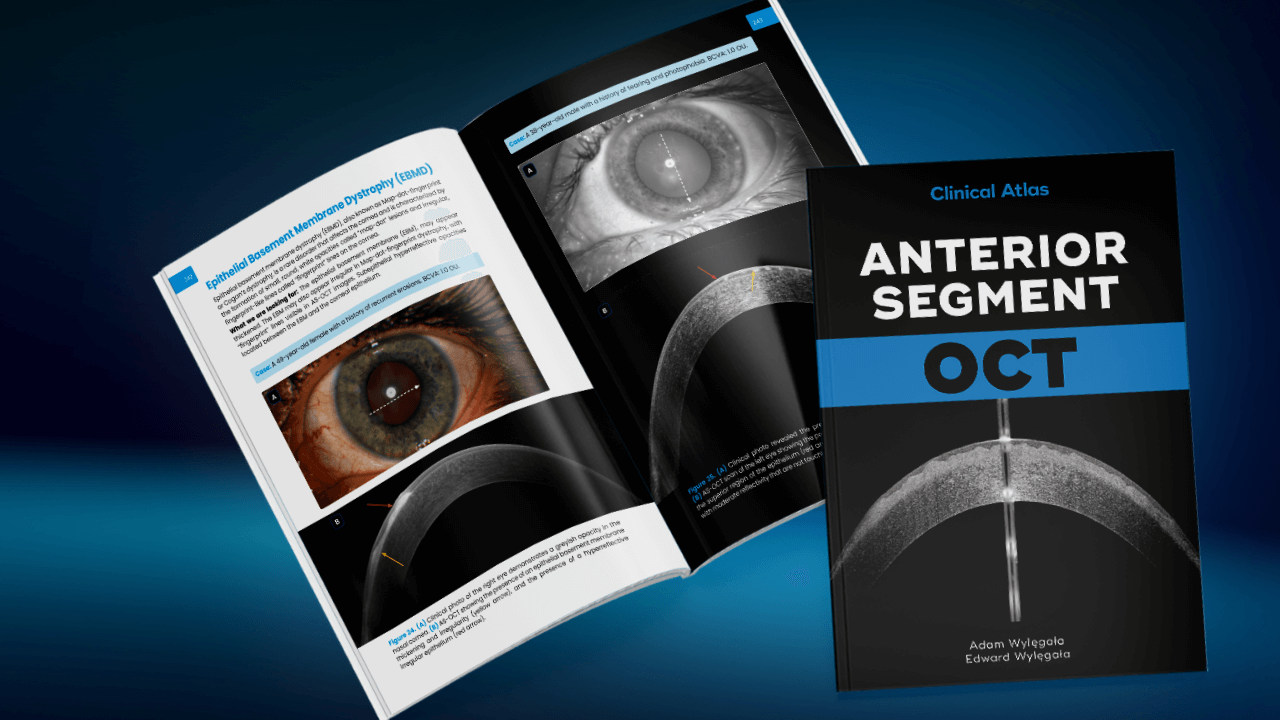 Premiera atlasu klinicznego pt. “Anterior Segment OCT”